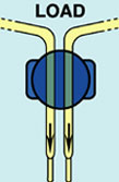B-LOK®-1A